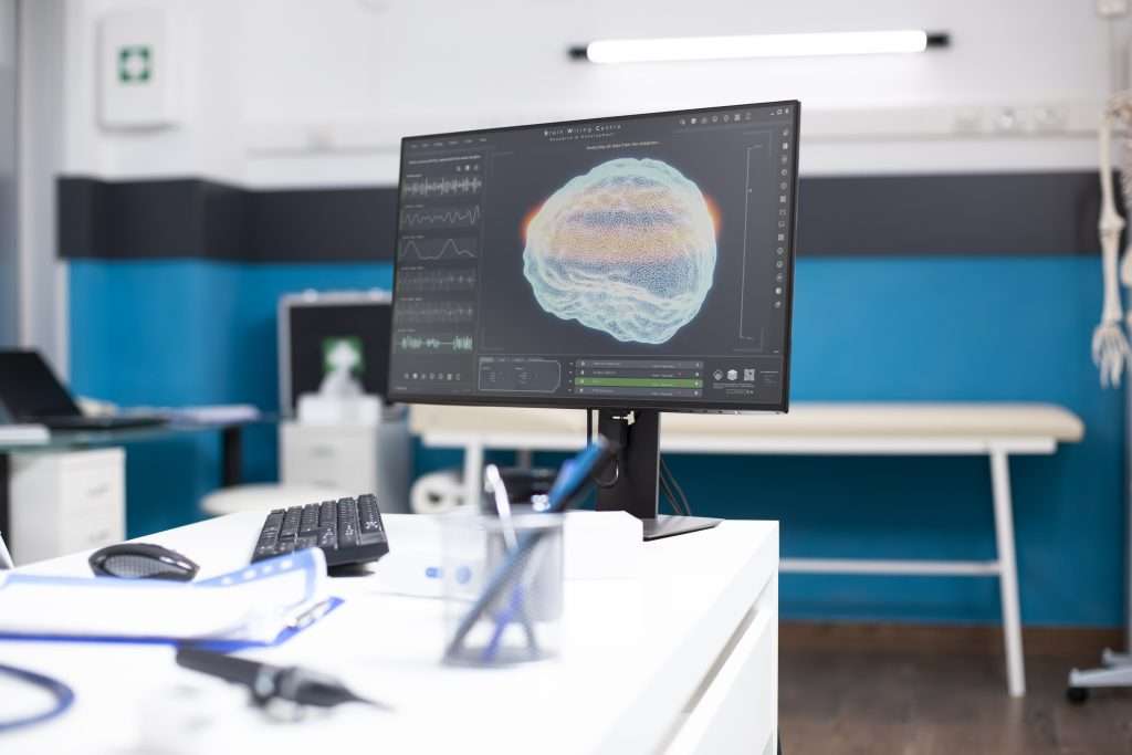GE vs Siemens AI Radiology
