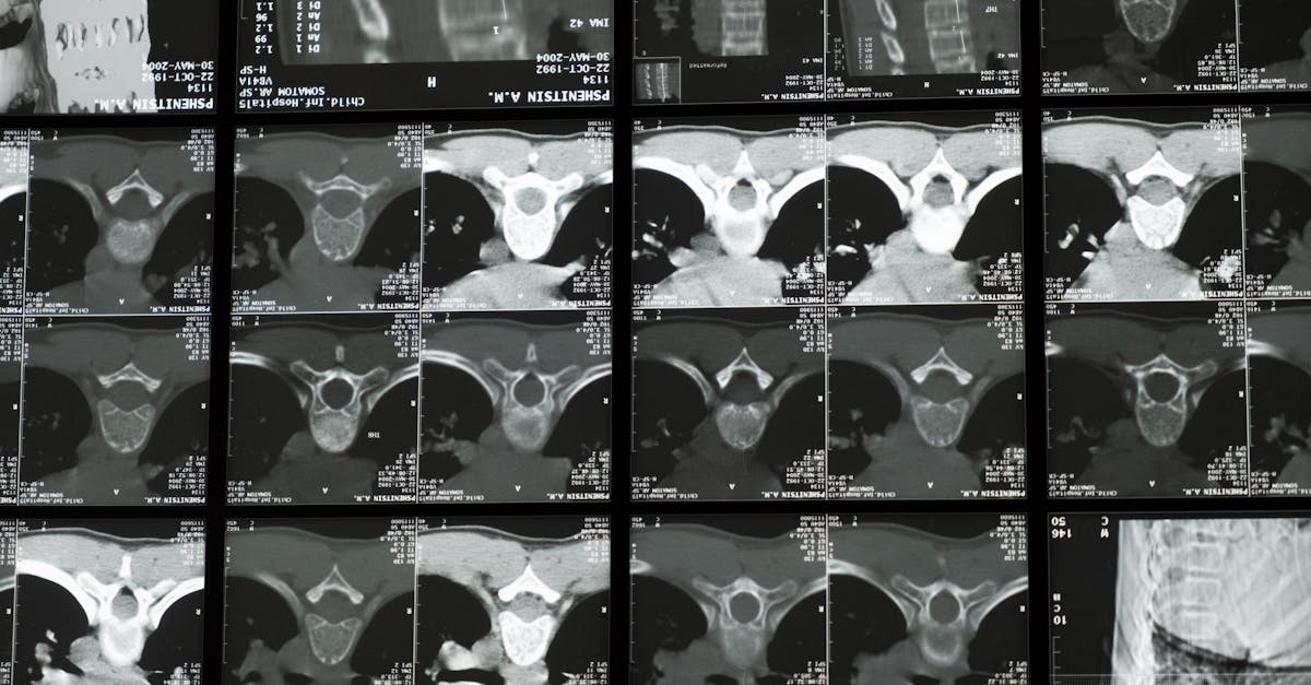 ai cdss for orthopedic clinics