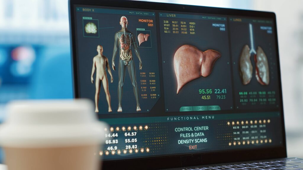 AI in Chronic Disease